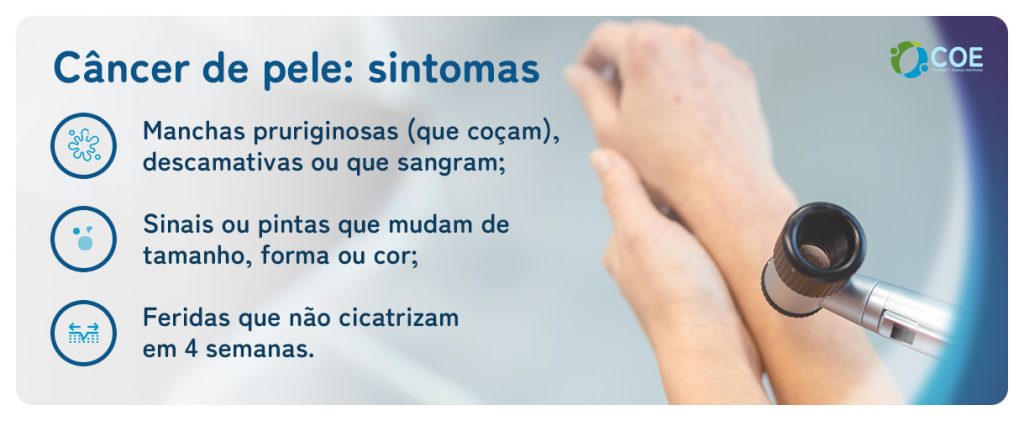 Manchas pruriginosas (que coçam), descamativas ou que sangram;
Sinais ou pintas que mudam de tamanho, forma ou cor;
Feridas que não cicatrizam em 4 semanas.