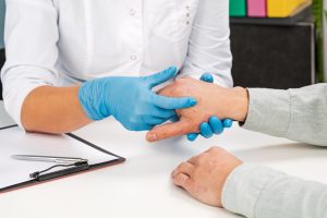 Dermatologista usando luvas examina a mão de um paciente doente, com foco nas unhas. exame e diagnóstico de psoríase na unha