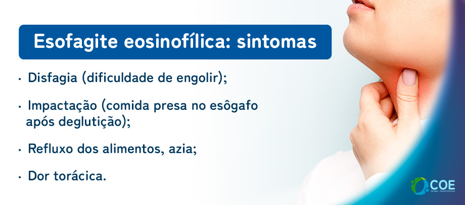 Disfagia (dificuldade de engolir);
Impactação (comida presa no esôgafo após deglutição);
Refluxo dos alimentos, azia;
Dor torácica.