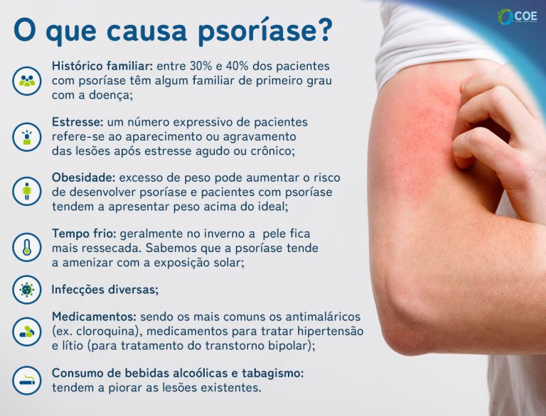 psor-ase-7-tratamentos-para-aliviar-os-sintomas-coe