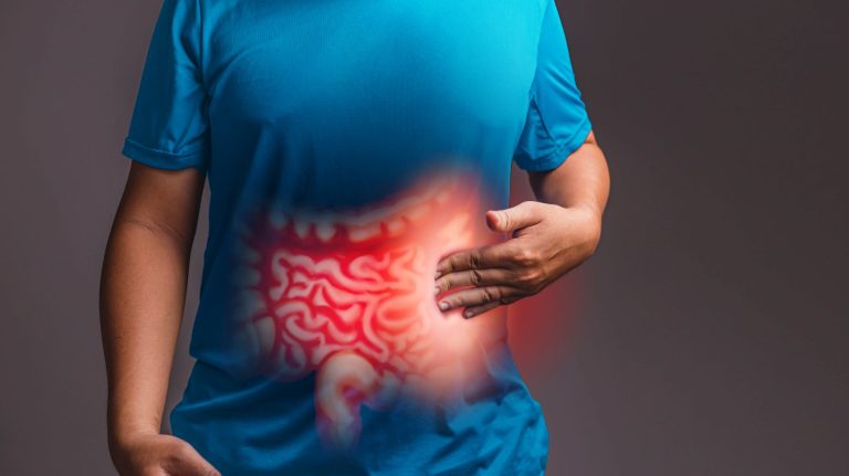 O câncer colorretal, também conhecido como câncer de intestino, é uma doença em que as células malignas crescem no cólon ou no reto, duas partes importantes do intestino grosso. É um tipo de câncer muito comum, que afeta mais os homens, porém, também atinge as mulheres. A faixa etária onde há mais ocorrência é acima dos 50 anos, porém, nos últimos anos, tem crescido o surgimento entre pessoas de 20 a 49 anos. Os sintomas do câncer colorretal incluem mudanças nos hábitos intestinais (diarreia, constipação ou mesmo mudanças no formato das fezes), dores ou desconfortos abdominais, sangue nas fezes, fadiga e perda de peso inexplicável. Esse é um tipo de câncer que pode ser evitado com exames de rastreio e tratamento em fases benignas.